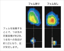 リアライン・インソール・フェムの効果